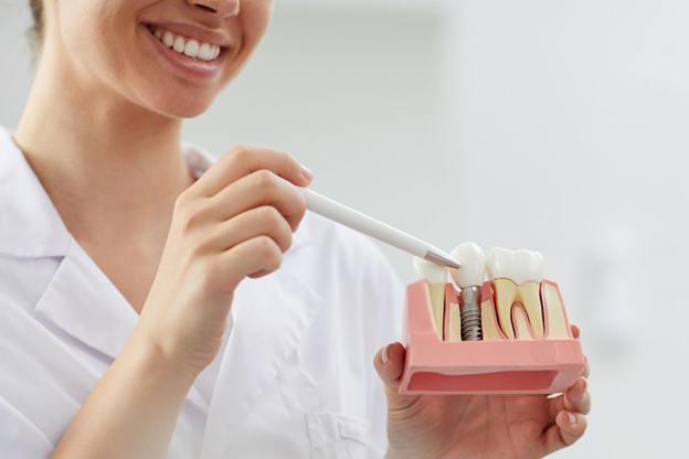 Taking Care of Dental Implants
